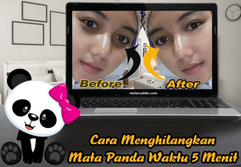 Cara Menghilangkan Mata Panda Dalam Waktu 5 Menit